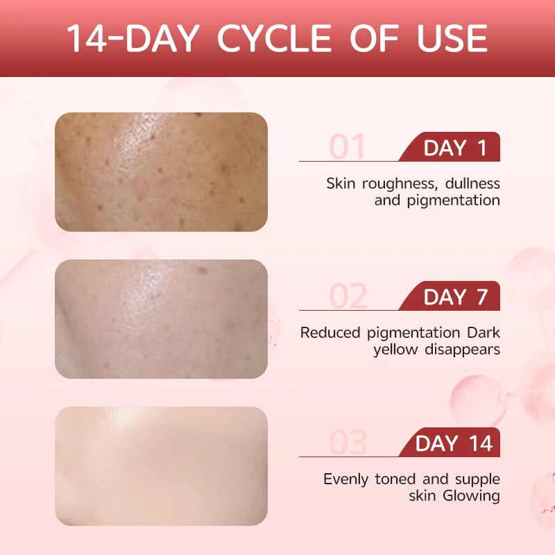 Korean OEM  Hyaluronic Acid Niacinamide 10% + TXA 4% Dark Spot Serum Hyperpigmentation Correcting Brightening Serum